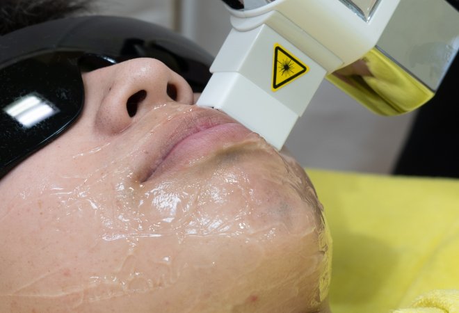 夫の脱毛で生じる浮気疑惑の実態